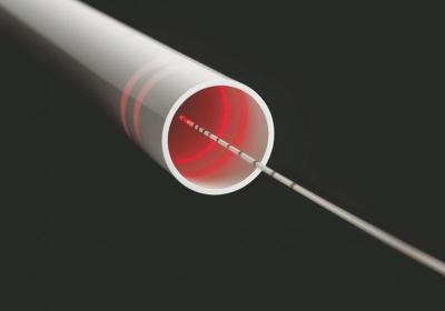 Laser-Vlákno | Ambulance cévní chirurgie Tábor